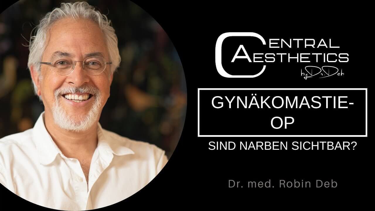 Video Gynäkomastie Narben, Dr. Deb, Central Aesthetics, Plastische Chirurgie Frankfurt