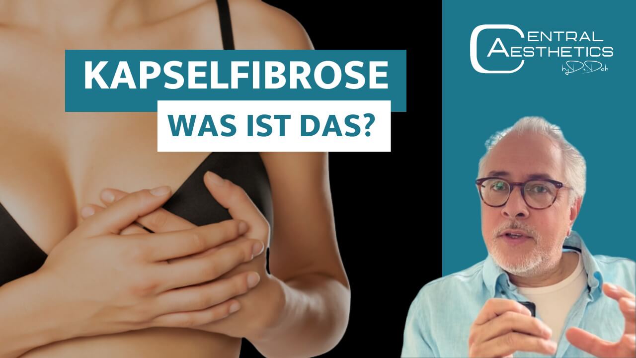 Video Kapselfibrose, Dr. Deb, Central Aesthetics, Plastische Chirurgie Frankfurt