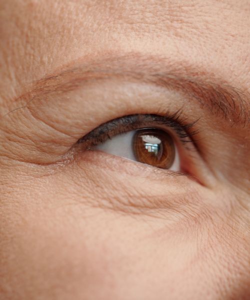 Augenlidstraffung in Nahaufnahme