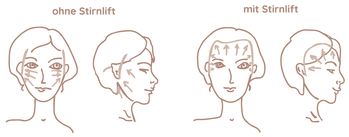 Facelift Grafik Frankfurt