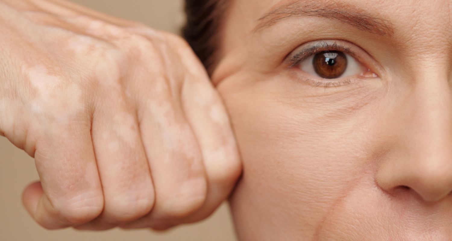 facelift-in-frankfurt Brustverkleinerung in Frankfurt