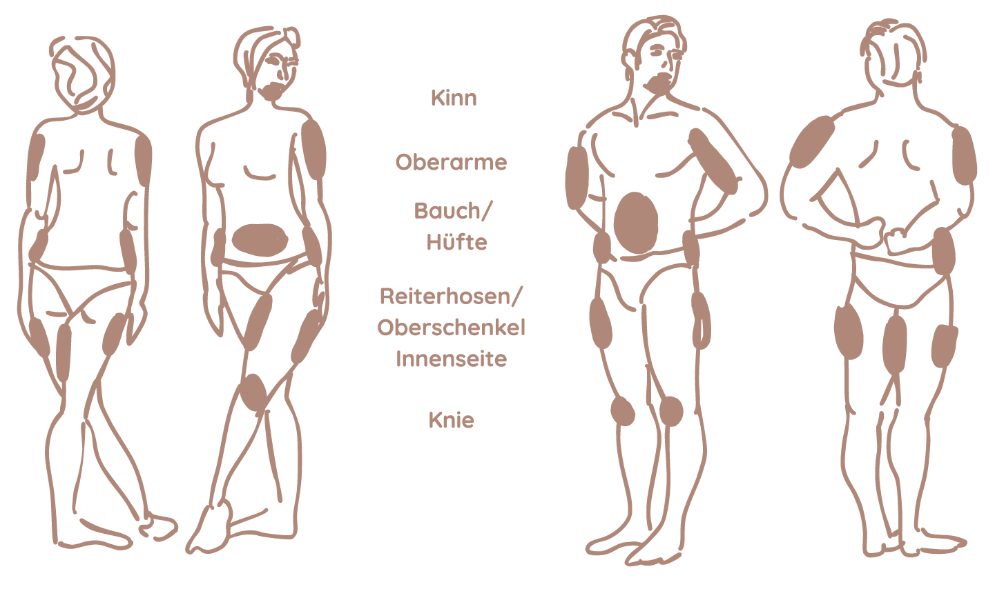 Fettabsaugung Grafik Frankfurt
