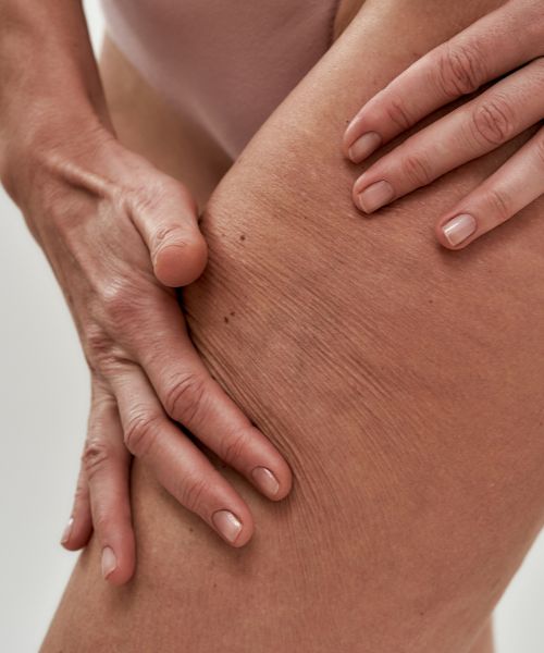 Augenlidstraffung in Nahaufnahme