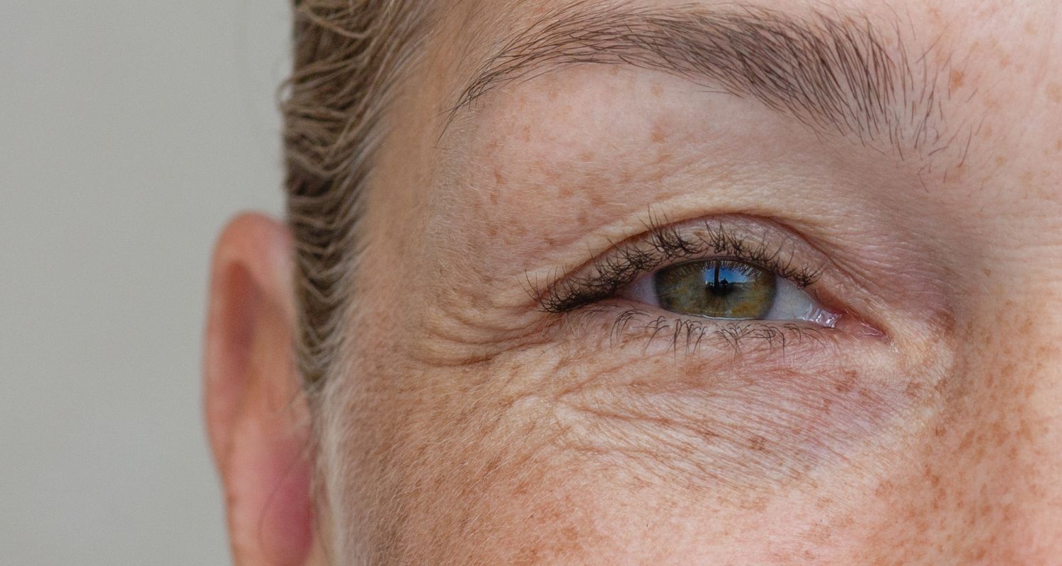 unterlidstraffung-in-frankfurt Bruststraffung in Frankfurt